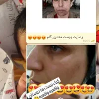پکیچ لاغری چاقی پوست مو کبدچرب ناباروری...|خدمات آرایشگری و زیبایی|اهواز, زیباشهر|دیوار