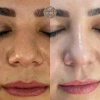 تنها یک جلسه تضمینی(50%اف)