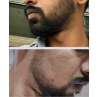 با سرم سیر سیاه اینجوری شدنا