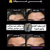 لیفت وایپر|آرایشی، بهداشتی، درمانی|تهران, شهرک محلاتی|دیوار
