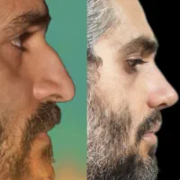 پی ارپی زانو. کمر. مچ پا.  شانه.  گردن