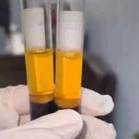 جشنواره پی آرپی ژل و بوتاکس مزوتراپی بلفارو|خدمات آرایشگری و زیبایی|اهواز, کیانپارس |دیوار