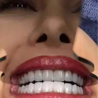 اموزش کامپوزیت
