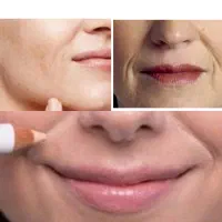 مراقبت پوست