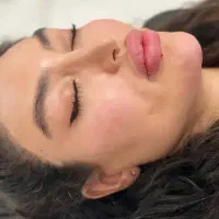 ژل و بوتاکس بادی وتخلیه چربی قیمت استثنایی