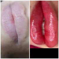 تخفیف ویژه به مدت محدود