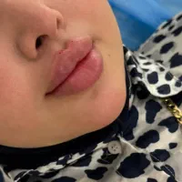 خدمات فیلروبوتاکس|خدمات آرایشگری و زیبایی|سنندج, |دیوار