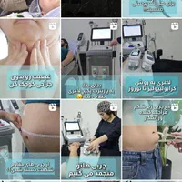 آف درمرکز زیبایی آریافر لیزر ولاغری وفیشیال و...|خدمات آرایشگری و زیبایی|اهواز, کیانپارس |دیوار