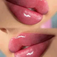 ژل بوتاکس گلوتاتیون سفید کننده بمدت ۳ روز خاش|خدمات آرایشگری و زیبایی|خاش, |دیوار