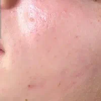 جشنواره فیشیال و پاکسازی و کلیه امور پوست و مو|خدمات آرایشگری و زیبایی|فردیس, فردیس|دیوار
