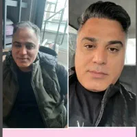 کاشت مو تخصصی