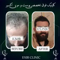 استخدام مشاور و مدیر داخلی خانم جهت کلنیک کاشت مو|استخدام درمانی، زیبایی، بهداشتی|تهران, جردن|دیوار