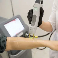 لیزر موهای زائد با دستگاه کندلا2025فول بادی فقط990|خدمات آرایشگری و زیبایی|قرچک, زیبا شهر|دیوار