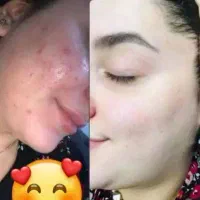 کرم شب اماراتی اصل و تضمینی