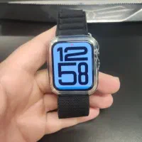 اپل واچ se 2024 battery 100