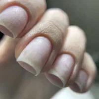 کاشت و ترمیم وپدیکورتخصصی|خدمات آرایشگری و زیبایی|شیراز, شهرک رضوان|دیوار
