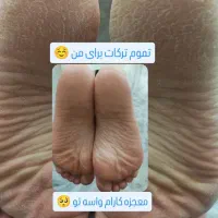 پدیکور وکف سابی و پارافین تراپی|خدمات آرایشگری و زیبایی|هشتگرد, هشتگرد قدیم|دیوار