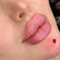 ژل بوتاکس مزو انزیم .پرسینگ .لیفت نخ .چال لپ|خدمات آرایشگری و زیبایی|شاهینشهر, شهرک پردیس|دیوار