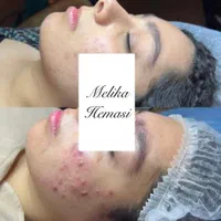 فیشیال و جوانسازی و پاکسازی صورت|خدمات آرایشگری و زیبایی|اصفهان, خلجا|دیوار