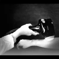 لیزر موهای زائد