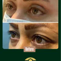 جشنواره خدمات پزشکی و جراحی و زیبایی در محدوده حرم|خدمات آرایشگری و زیبایی|مشهد, بالا خیابان|دیوار