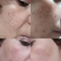 پاکسازی پوست فروش محصولات آرایشی و بهداشتی صورت...|خدمات آرایشگری و زیبایی|گلبهار, |دیوار