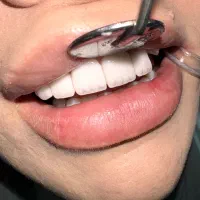 دندانپزشکی هرا ویزیت مشاوره رایگان|خدمات آرایشگری و زیبایی|اندیشه, اندیشه فاز ۳|دیوار