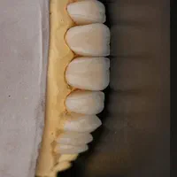 لابراتوار پروتزهای دندانی ثابت