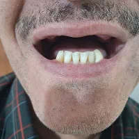 ساخت دندان|خدمات آرایشگری و زیبایی|خرمدره, |دیوار