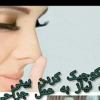 کرم سفید کننده دست وپا صورت کاملا بدون بازگشت|آرایشی، بهداشتی، درمانی|مشهد, کوه سنگی|دیوار