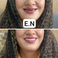 دندان سازی|خدمات آرایشگری و زیبایی|اردبیل, |دیوار