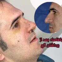 عمل جراحی بینی بامتخصص گوش،حلق،بینی|خدمات آرایشگری و زیبایی|تهران, یوسف‌آباد|دیوار