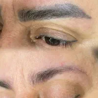 پاک کردن ریموو تتو های قدیمی صورت با مواد.بدون درد