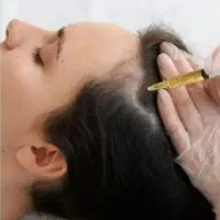 پی آر پی حجامت بادکش گرم فصد خون زالو مزاج شناسی|خدمات زیبایی و سلامت|تهران, مجیدیه|دیوار