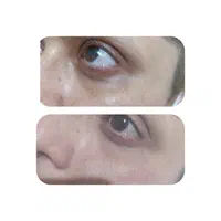 خدمات ژل و بوتاکس|خدمات آرایشگری و زیبایی|شیراز, نصرآباد|دیوار