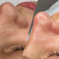 افر ویژه پاکسازی و فیشال صورت ۶۵۰
