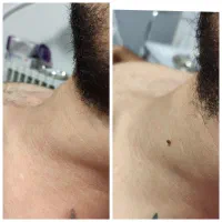 جلسه اول رایگان به مناسبت سالگرد افتتاحیه|خدمات آرایشگری و زیبایی|تبریز, |دیوار