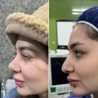 عمل زیبایی بینی