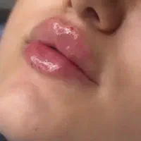 آفر ویژه جوانساز ،سلول بنیادی