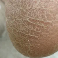 خدمات اسپای دست و پا /پدیکور و مانیکور /ژلیش پا