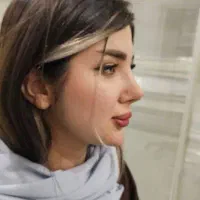 آف محدودزیبایی بینی دراهواز۲۵تومن فقط