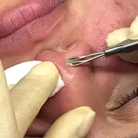 آموزش پاکسازی  پوست در آموزشگاه فنی و حرفه ایی|خدمات آموزشی|اصفهان, جلفا|دیوار