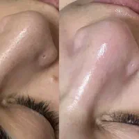 تخفیف ویژه فشیال و پاکسازی ویژه بانوان
