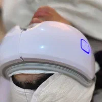 اموزش فیشال پوست به صورت حرفه ای