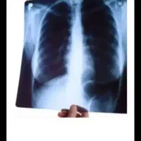 خرید و فروش عکس رادیولوژی به بالاترین قیمت