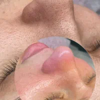 مدل فیشال و پاکسازی