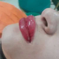 میکروبلیدینگ و میکروپیکمنتیشن ابرو و اصلاح تخصصی