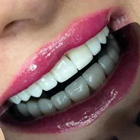 اقساط بدون پیش پرداخت خدمات دندانپزشکی