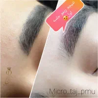 میکروبلیدینگ،میکروپیگمنتیشن و ریموو به قیمت قبل