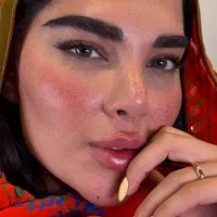 فیلرلب کلینیک مهرزاد-۵ میلیون تخفیف